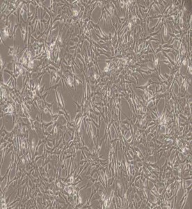 ES-2人卵巢透明細胞癌細胞主圖