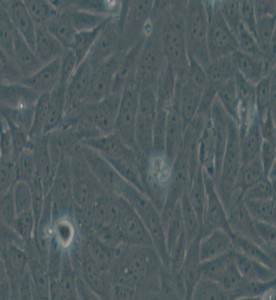 HOS人骨肉瘤細(xì)胞主圖