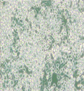 MIA PaCa-2人胰腺癌細胞主圖