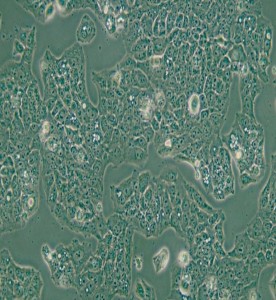 MS751人子宮頸表皮癌細胞主圖