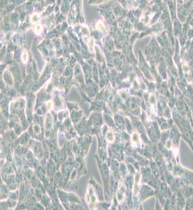NCI-H295R人腎上腺皮質腺癌細胞主圖