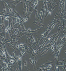 NCI-H1975人肺腺癌細胞主圖