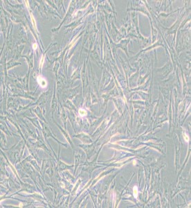 NCI-H2452[H2452]人間皮瘤細(xì)胞主圖