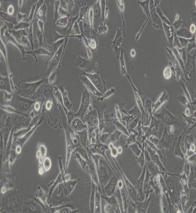 PC-3人前列腺癌細(xì)胞主圖