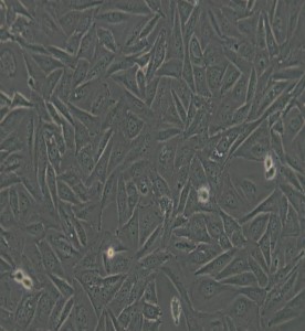 Saos-2人成骨肉瘤細(xì)胞主圖