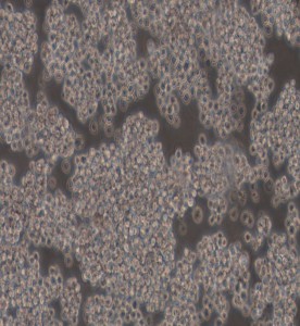 NB4人急性早幼粒細胞白血病細胞主圖