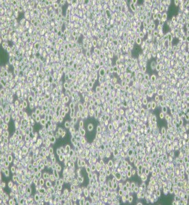 RPMI 8226人多發性骨髓瘤外周血B淋巴細胞主圖