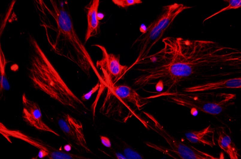 小鼠真皮成纖維細胞主圖