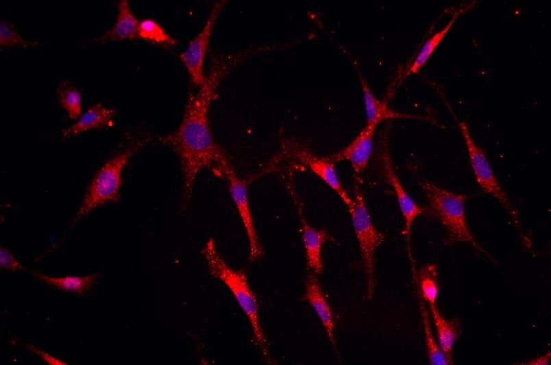 小鼠關(guān)節(jié)軟骨細(xì)胞主圖