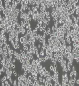 KATO III[KATO 3]人胃癌細胞主圖