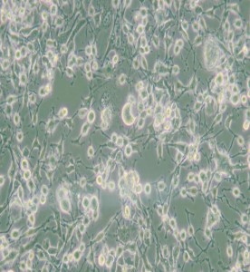 MDA-MB-436人乳腺癌細(xì)胞(L15)主圖